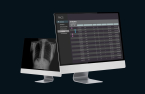 HealthQuest picks Korea’s Lunit for first investment in Asia