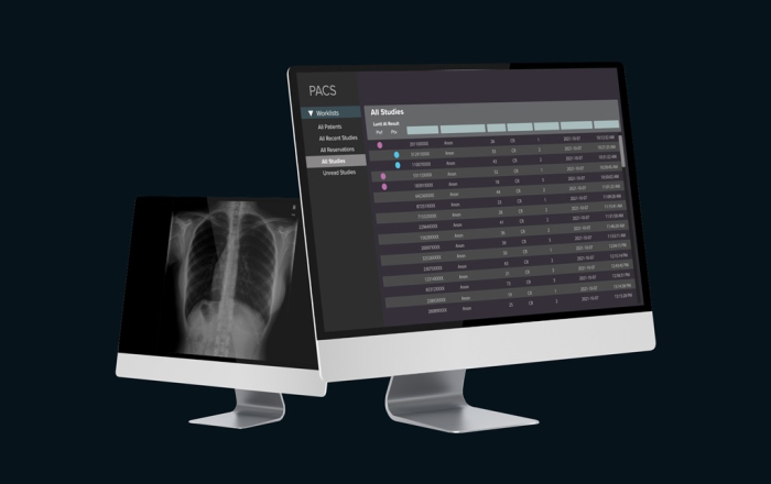 Lunit　Insight　CXR　Triage