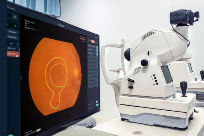 Vuno　Med-Fundus　AI,　a　solution　that　provides　findings　for　retinal　disease　diagnosis　(Courtesy　of　Vuno)