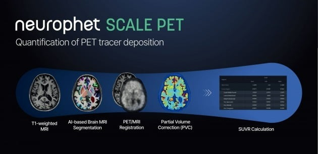 Neurophet SCALE PET image