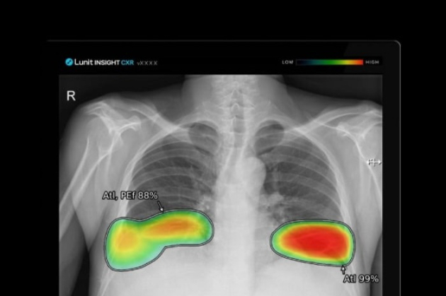 Lunit　exports　AI　imaging　analysis　solution　to　Brazil　