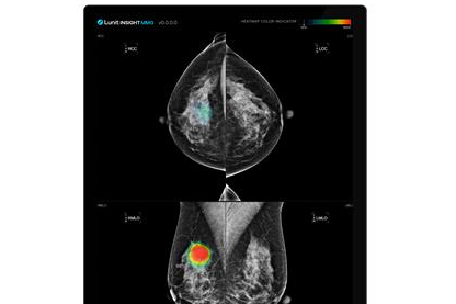 Lunit　Insight　MMG