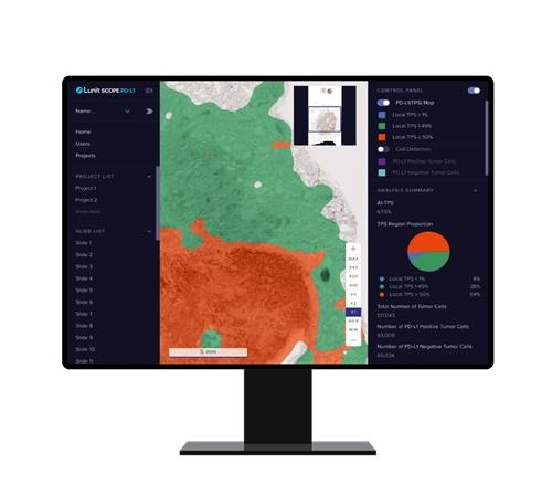 Lunit　SCOPE　PD-L1,　an　AI　solution　for　detecting　and　analyzing　cancer　biomarker　PD-L1