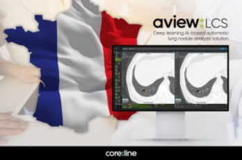 Coreline　Soft　to　supply　AI　diagnosis　solution　to　France