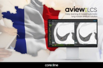Coreline Soft to supply AI diagnosis solution to France