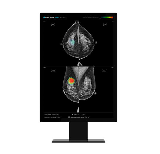 Lunit Insight MMG