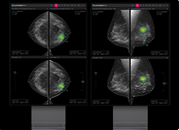 Lunit's Insight DBT gets certification from EU for medical device