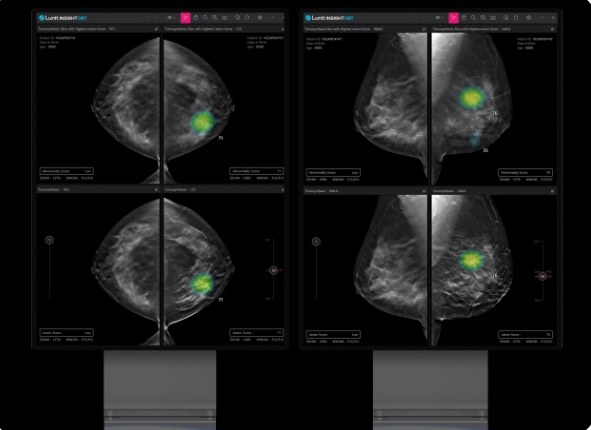 Lunit's　Insight　DBT　gets　certification　from　EU　for　medical　device　