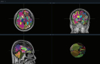 Vuno's brain imaging AI medical device secures FDA certification 
