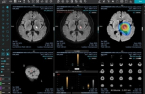 JLK supplies AI stroke solutions to Philippines