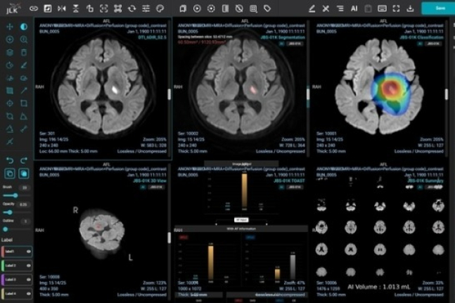 JLK supplies AI stroke solutions to Philippines