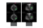 Lunit gets FDA approval for AI cancer diagnosis solution 