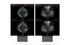 Lunit gets FDA approval for AI cancer diagnosis solution 