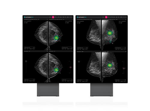 Lunit gets FDA approval for AI cancer diagnosis solution