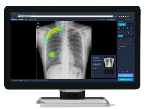 Lunit's　Insight　CXR