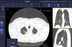 Vuno, Canon to target AI diagnostic market in Japan