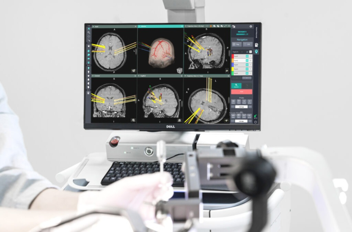 Kymero,　Koh　Young's　neurosurgical　robot　(Courtesy　of　Koh　Young)