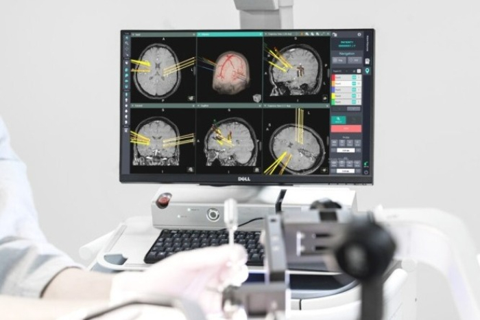 Geniant　Cranial,　Koh　Young's　neurosurgical　robot　(Courtesy　of　Koh　Young)